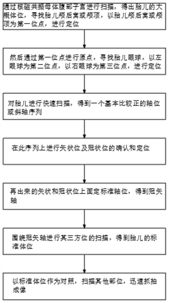 Fetal craniocerebral scanning three-point plane positioning method