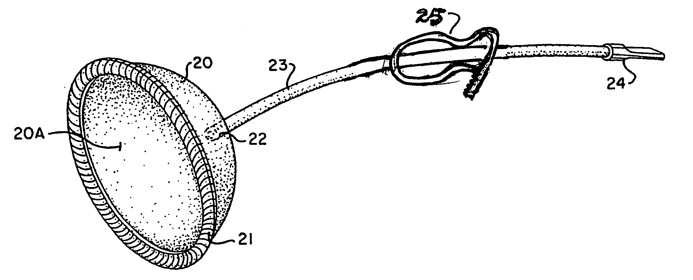 Breast tissue expanding device