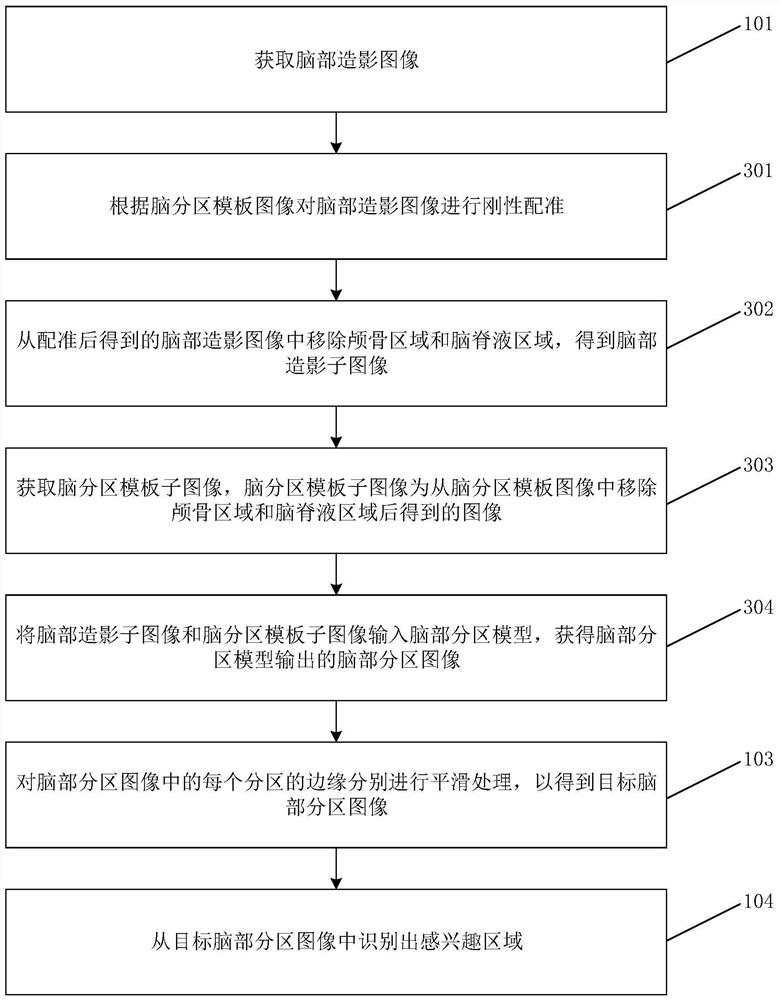 Brain contrast image processing method and device, medium and electronic equipment
