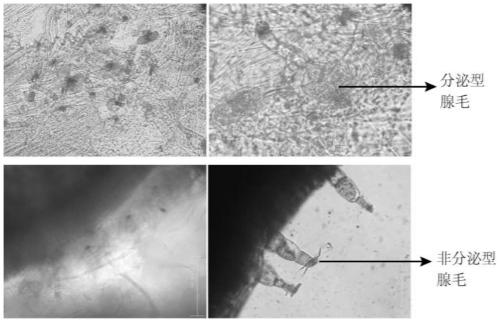 The dominant expression of aatcp15 gene promoter and its application in the glandular hairs of Artemisia annua