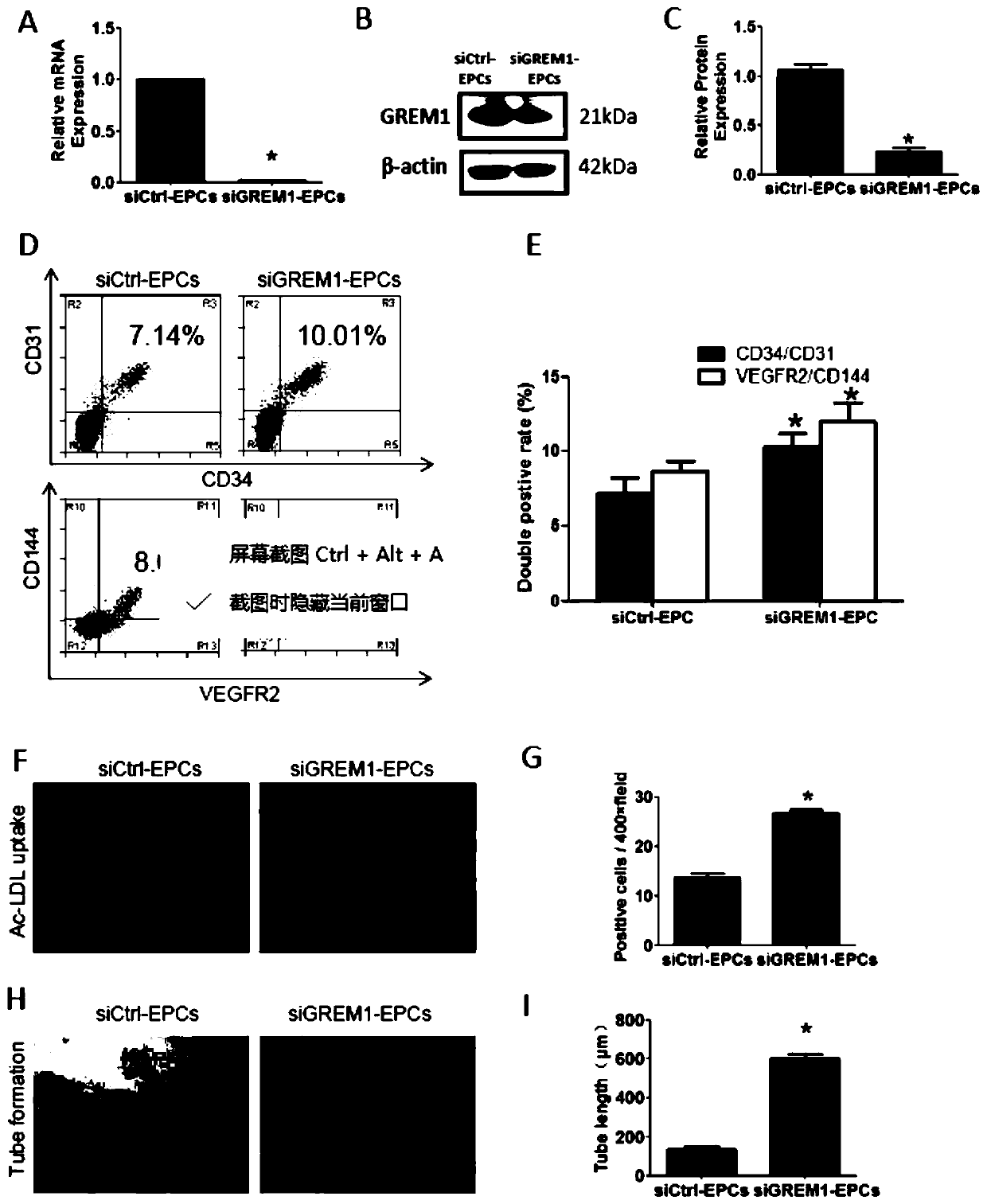 Method for inducing differentiation of human induced pluripotent stem cells into endothelial progenitor cells