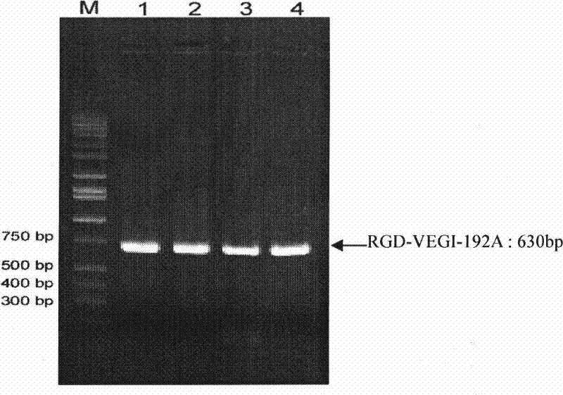 Human vascular endothelial cell growth inhibition factor jogged polypeptide, preparation thereof and use in targeted antineoplastic activity