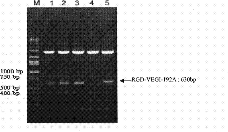 Human vascular endothelial cell growth inhibition factor jogged polypeptide, preparation thereof and use in targeted antineoplastic activity