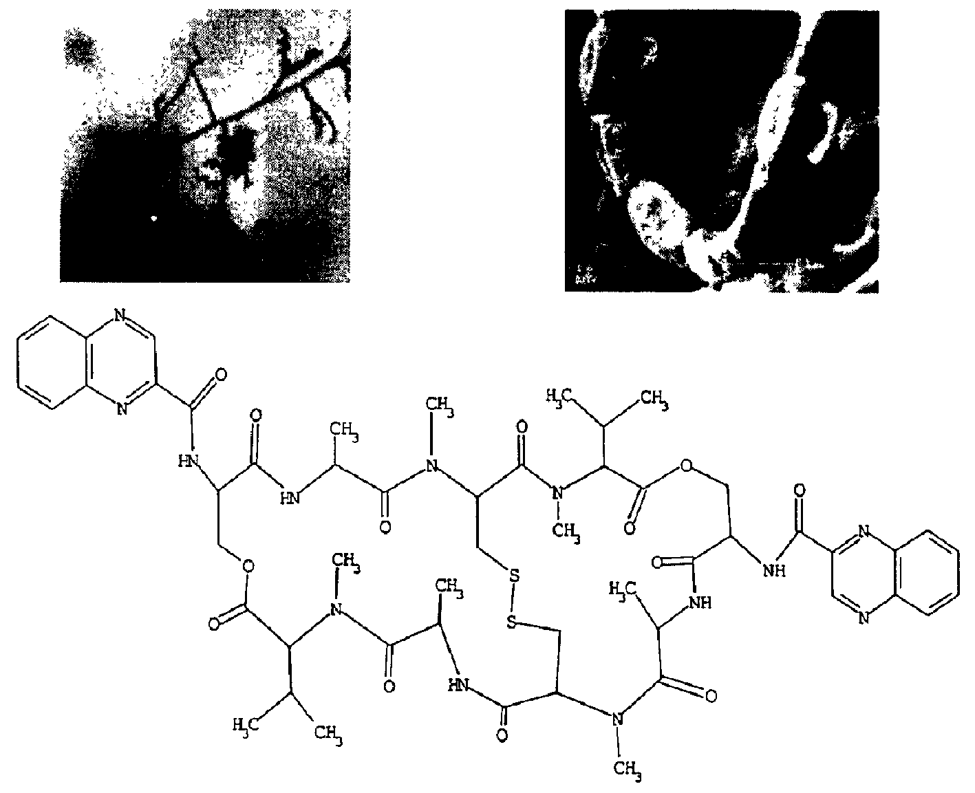 Bactericide bandung mycin and its upplication