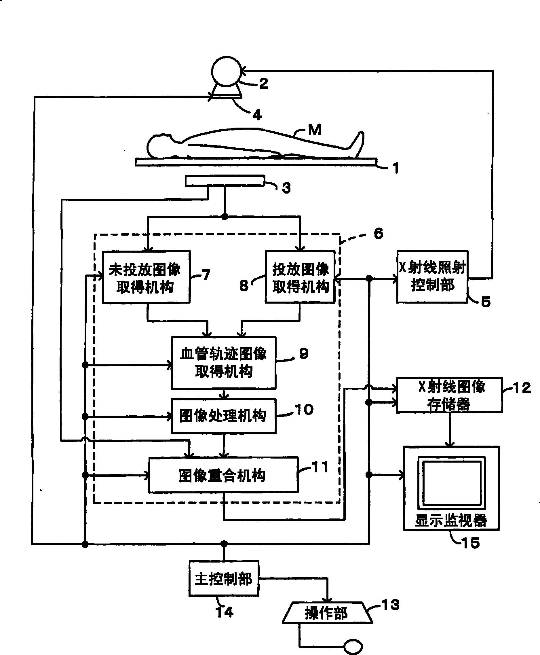 Radiographic apparatus