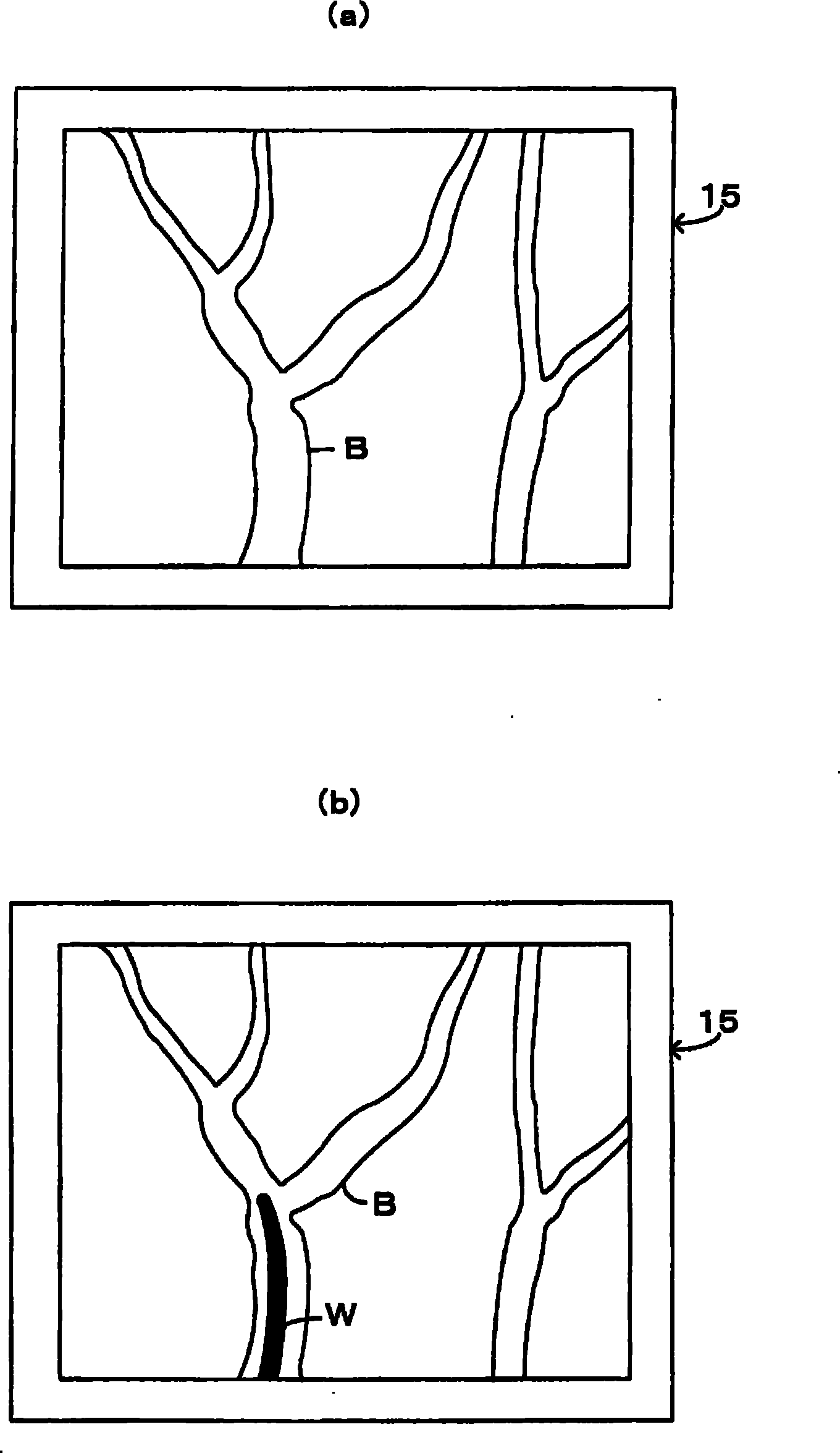 Radiographic apparatus