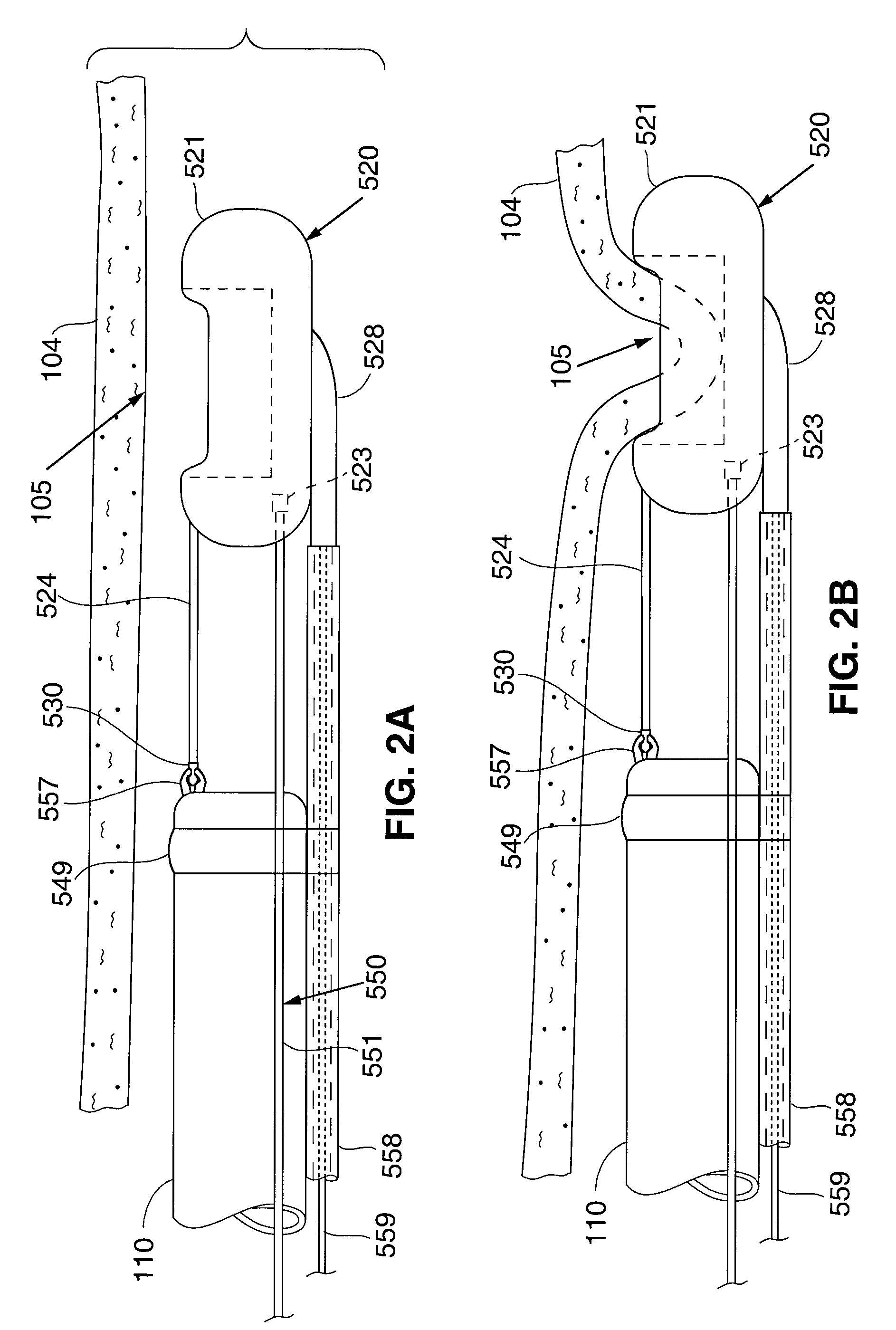 Endoscopic Instrument for Engaging a Device