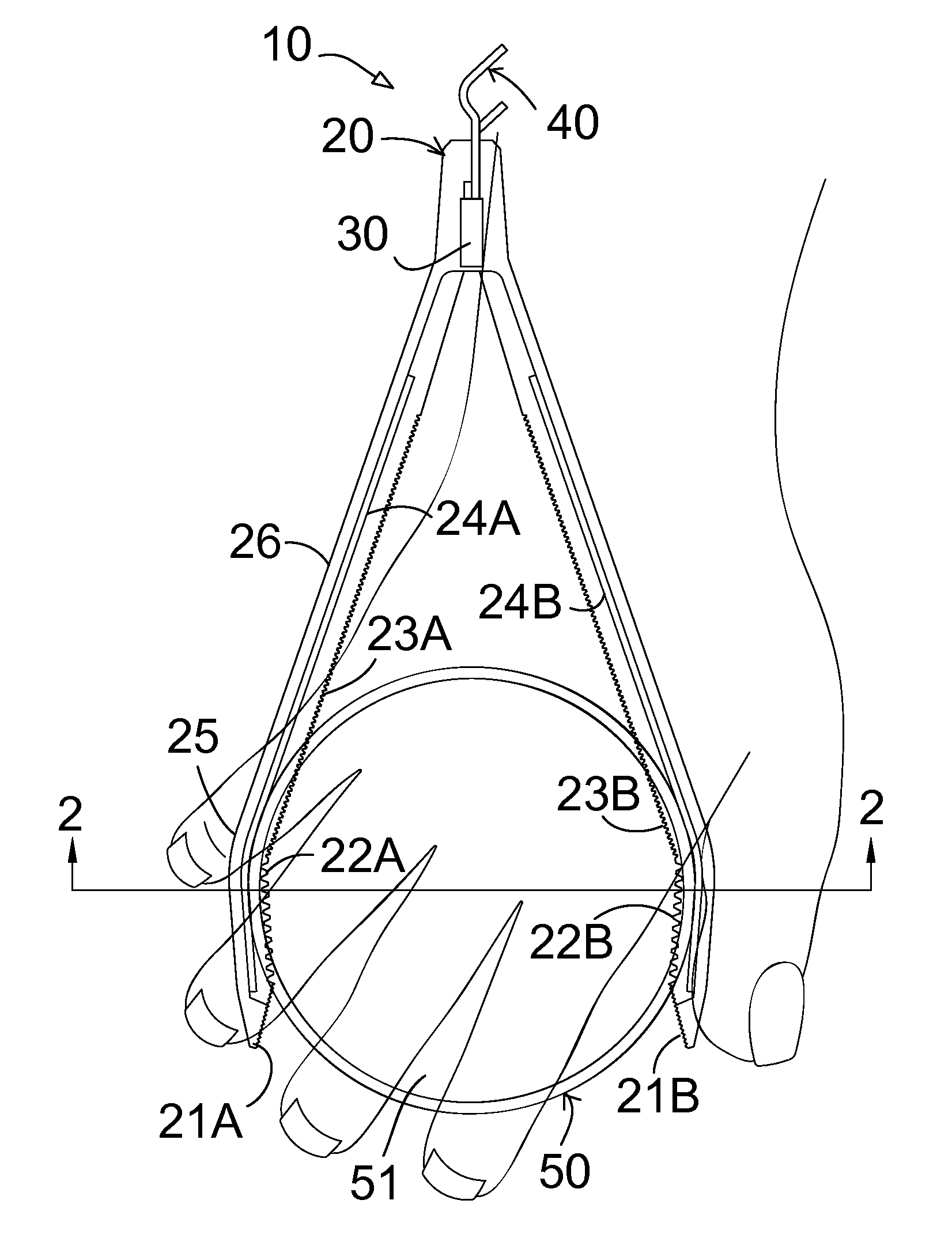 Lid opening tongs with torque arm