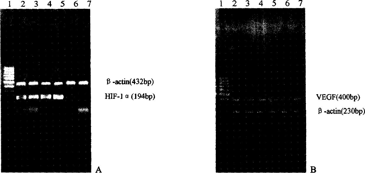 Interference RNA miniplasmid of hypoxia induction factor