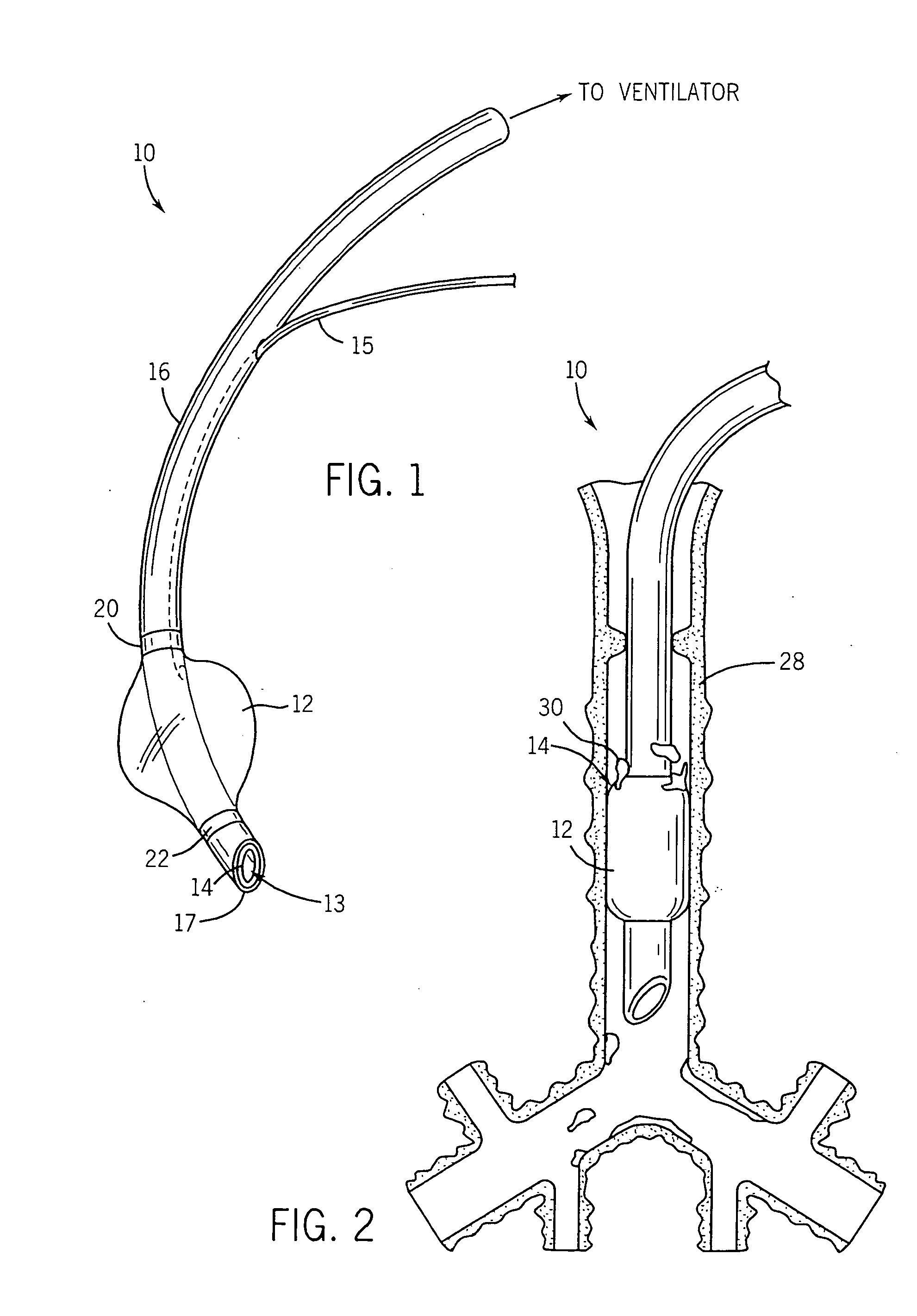 Endotracheal tube and technique for using the same