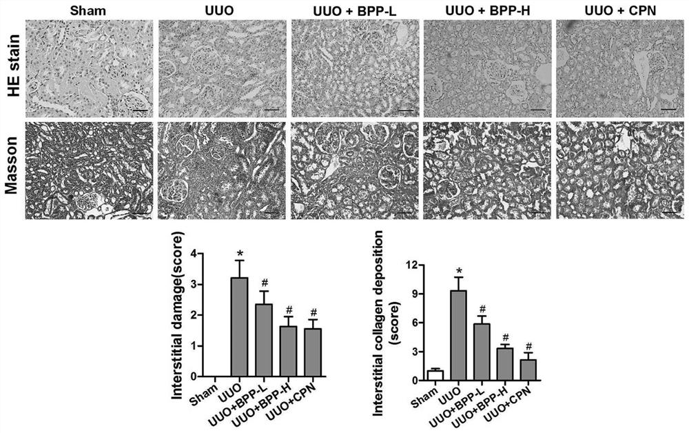 Application of Balanophora extract in preparation of anti-renal fibrosis drug