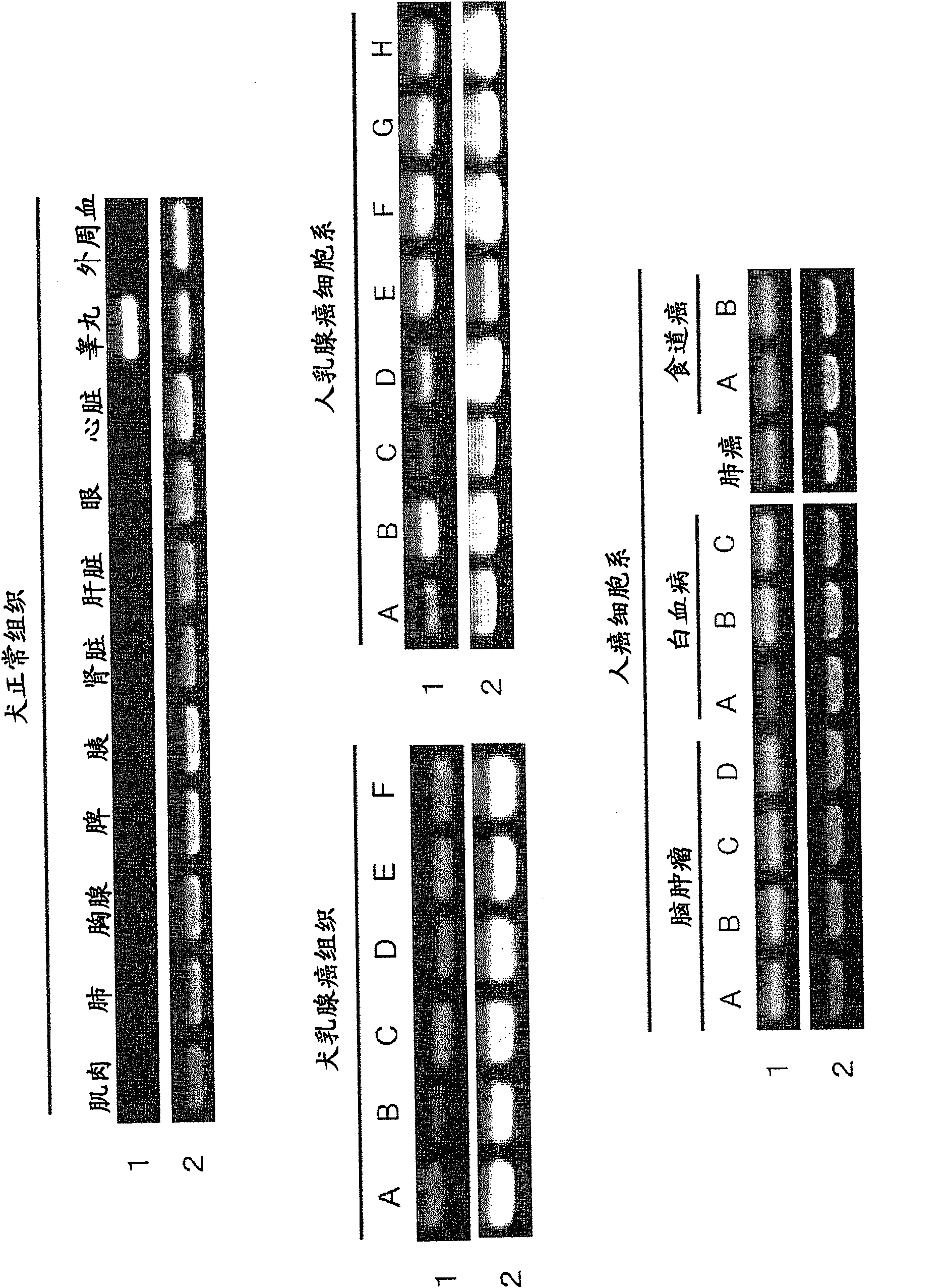 Cancer detection method