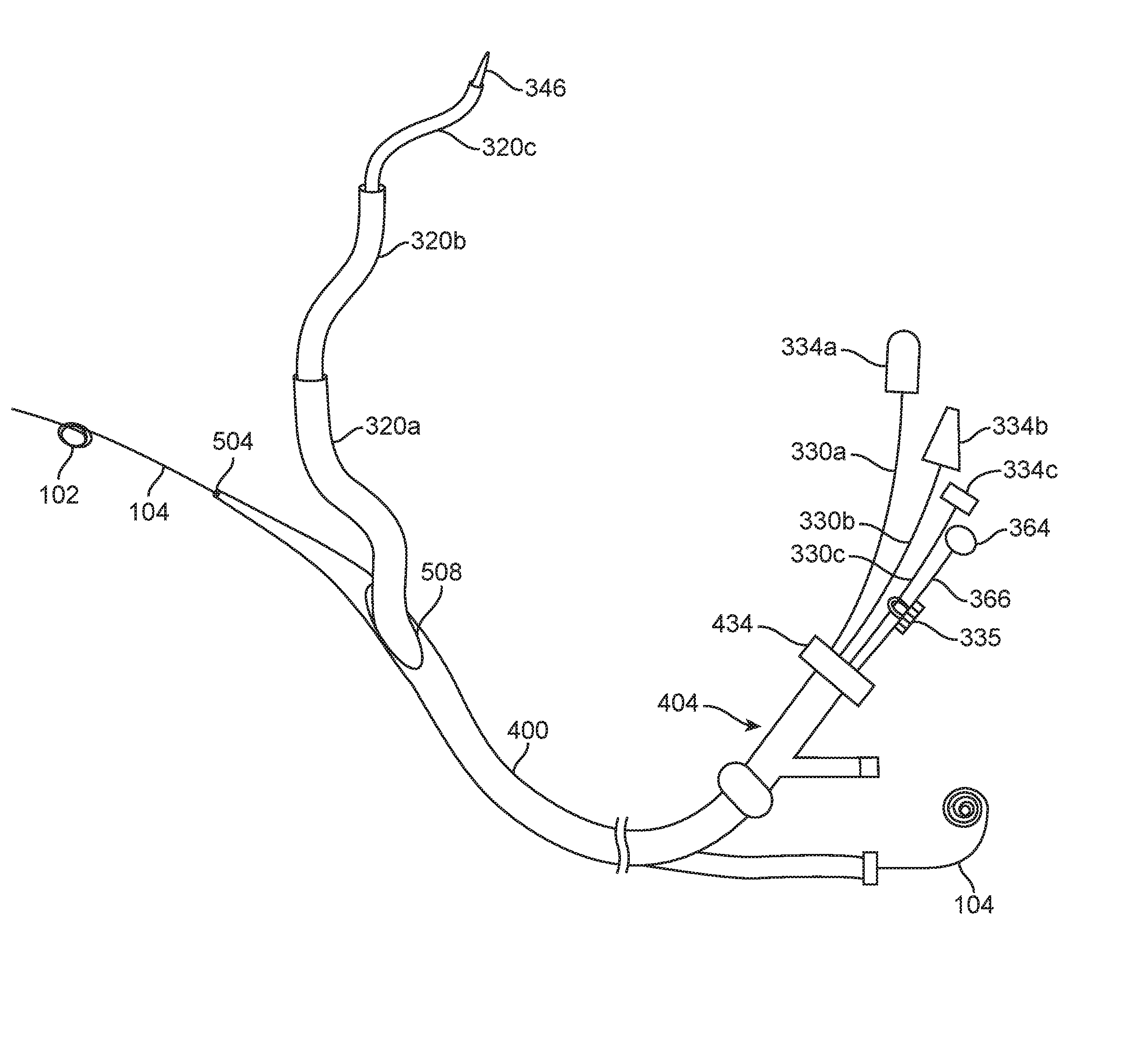 Anchoring delivery system and methods
