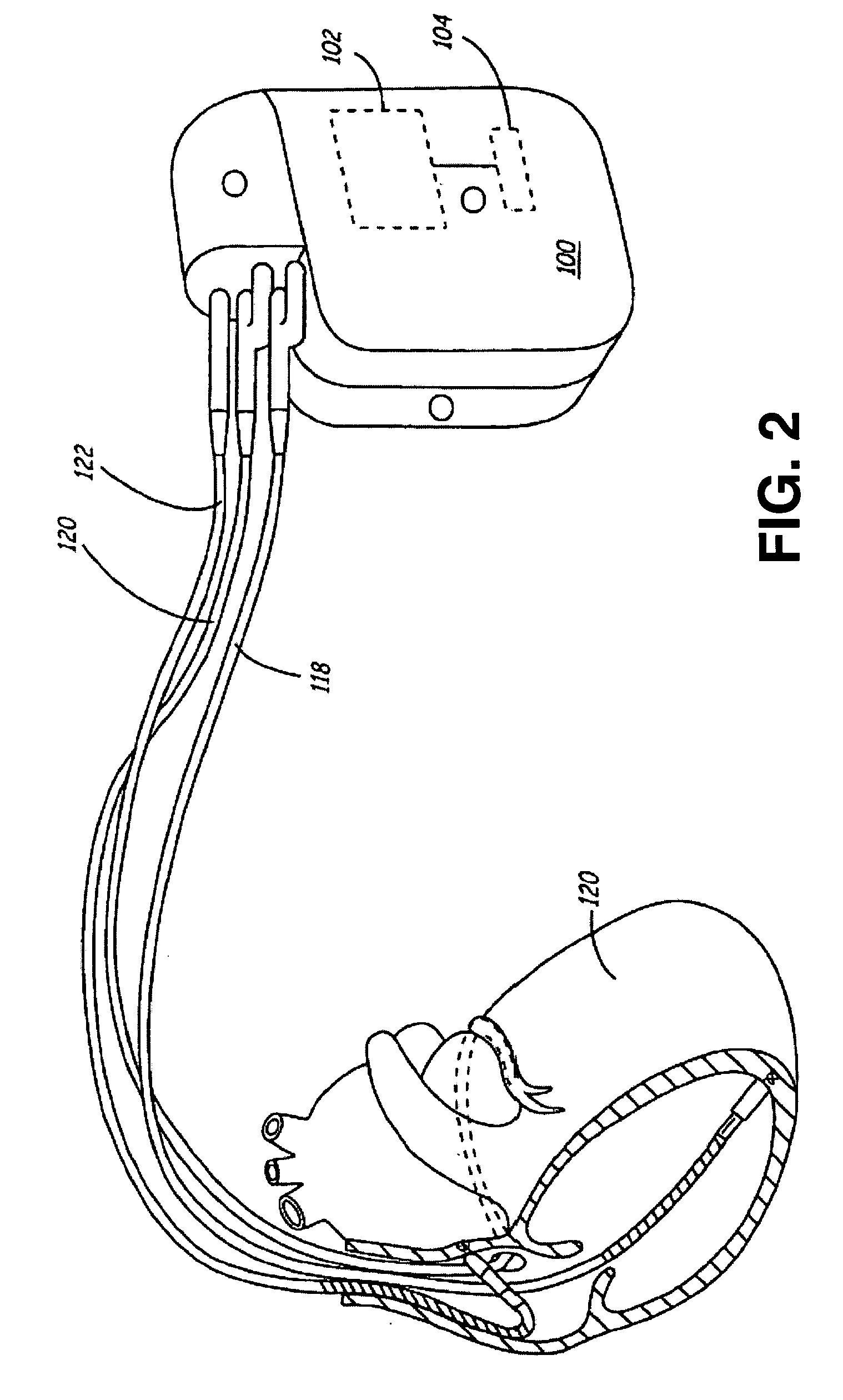 Method and apparatus for muscle function measurement