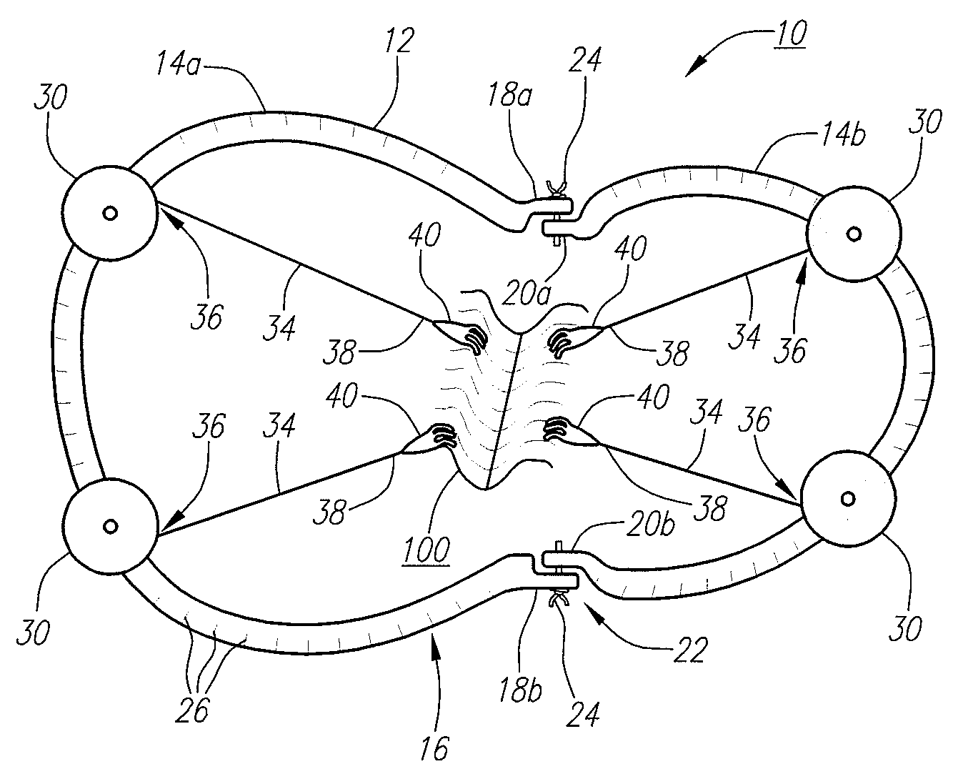 Surgical retractor device and method of use