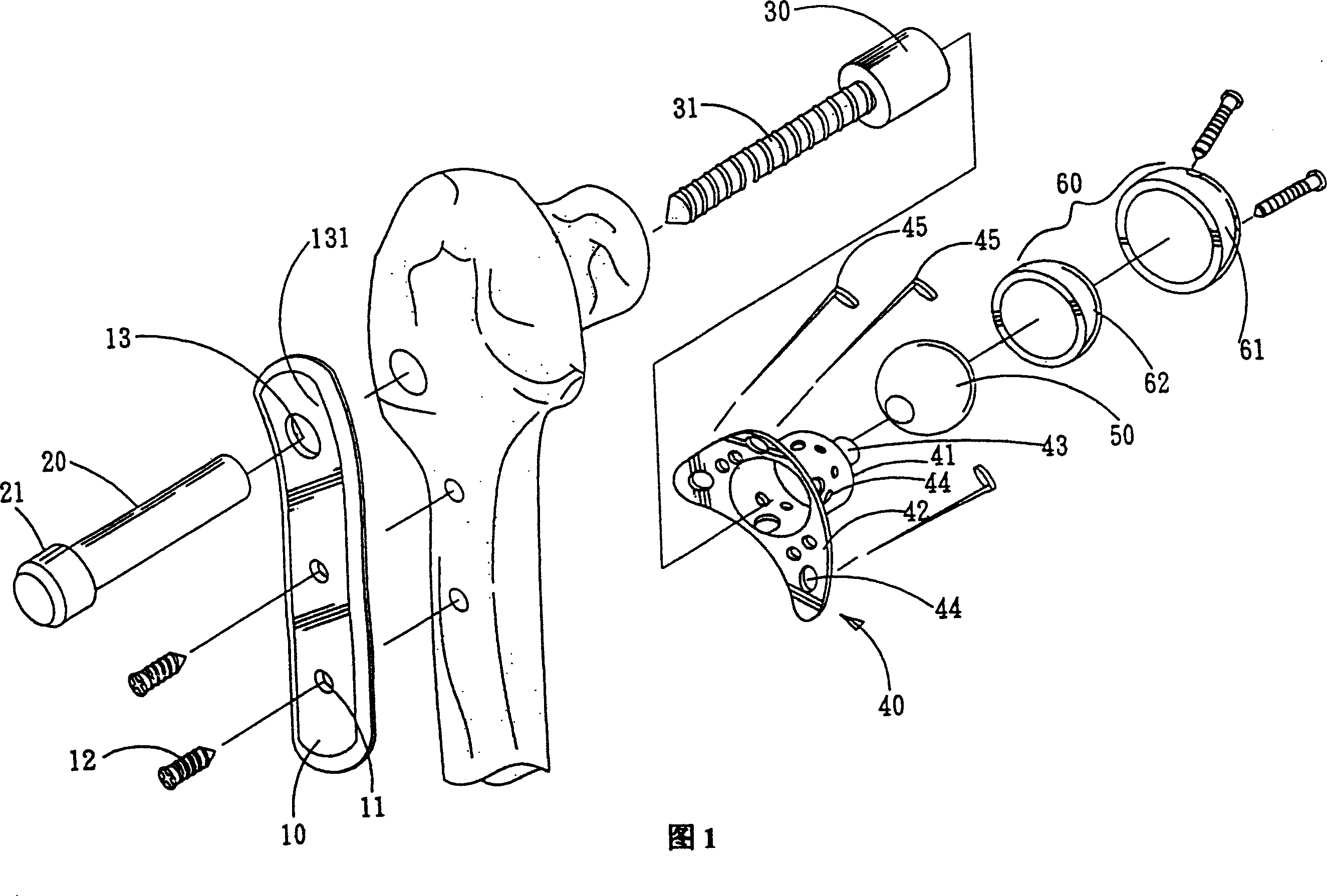 Artificial hip joint device without handle