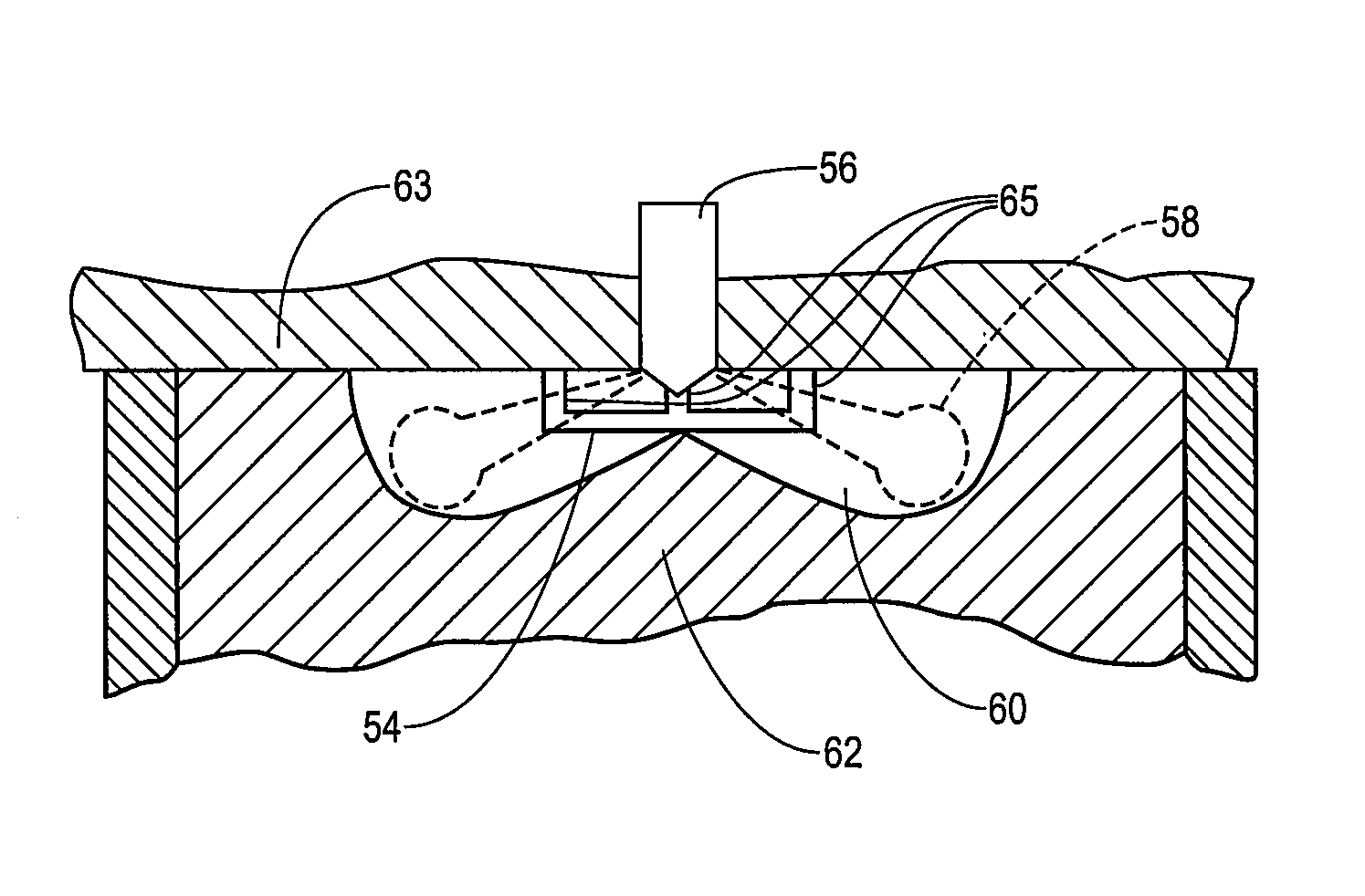 Direct injection combustion chamber geometry