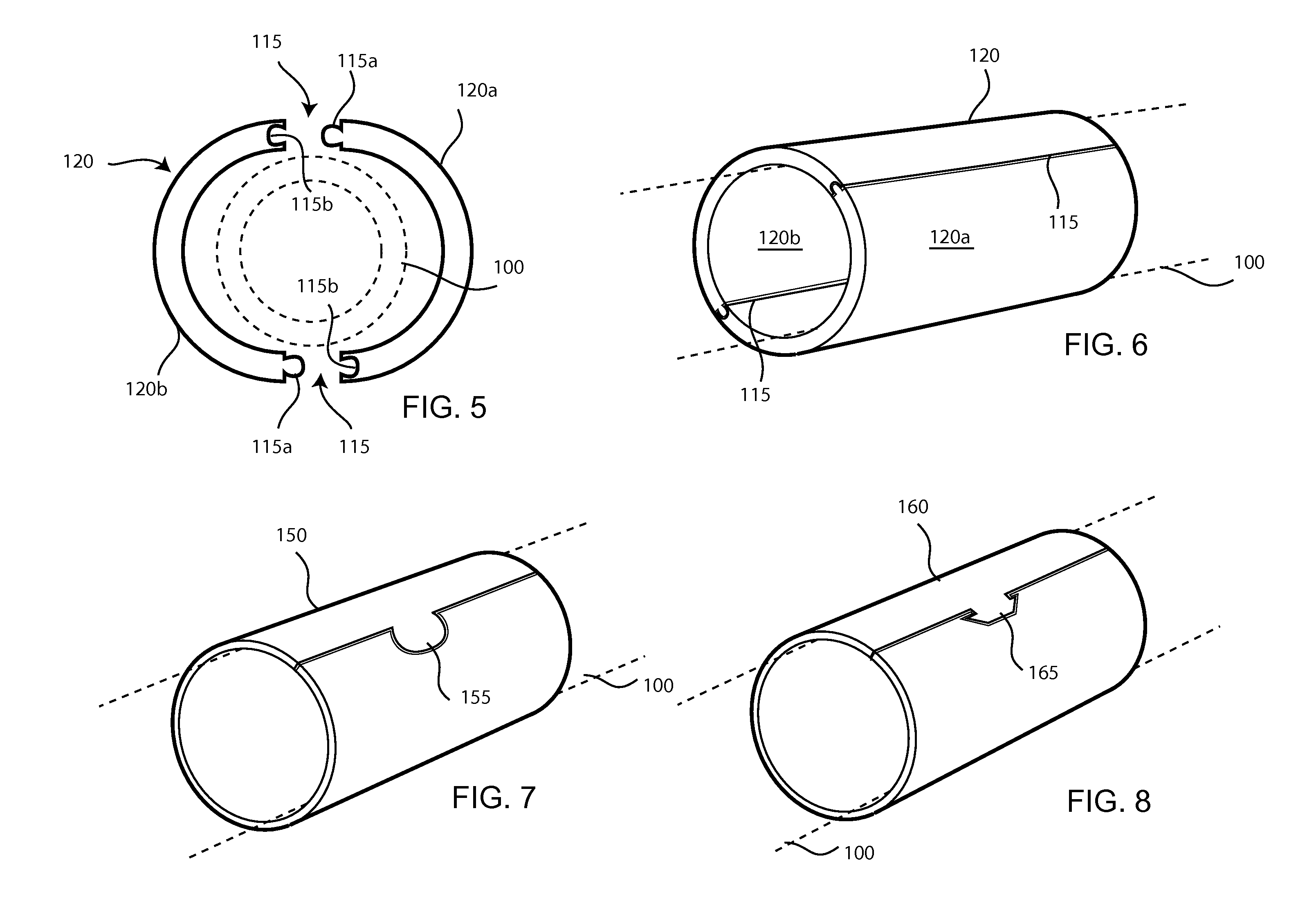 Method for deploying a sleeve and tubing device for restricting and constricting aneurysms and a sleeve and tubing device and system