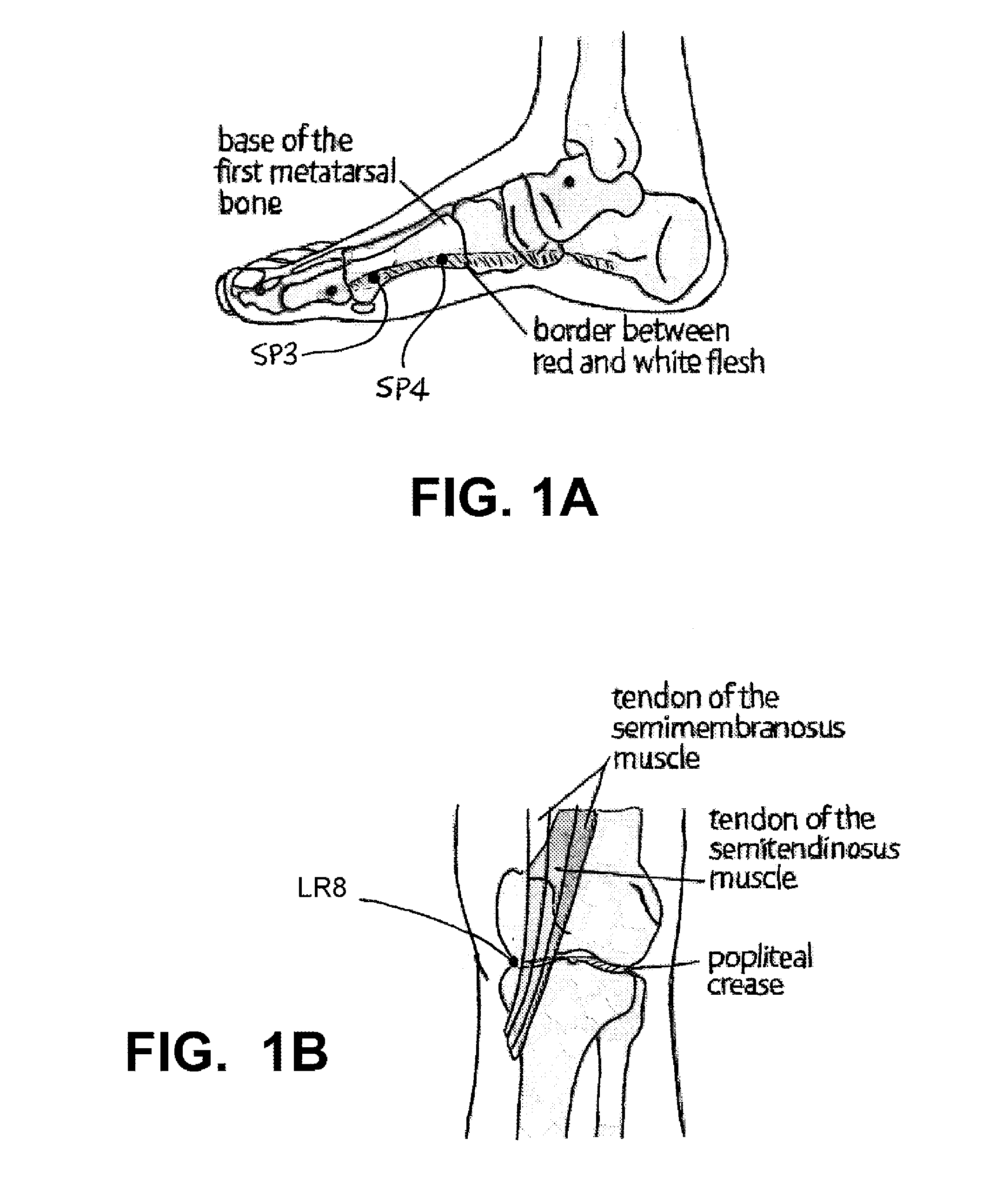 Implantable Electroacupuncture System and Method for Treating Dyslipidemia and Obesity