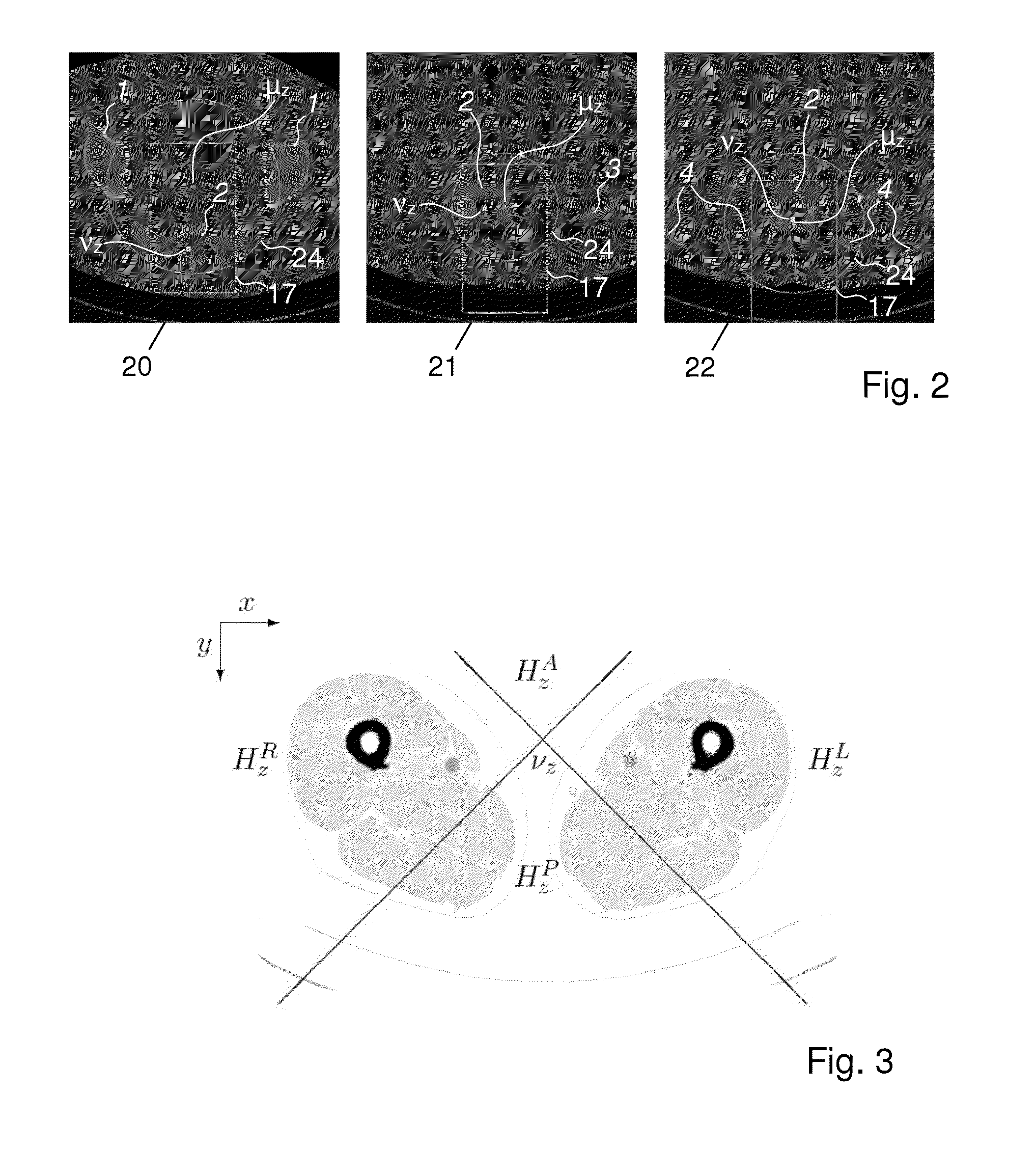 Method, apparatus and system for localizing a spine