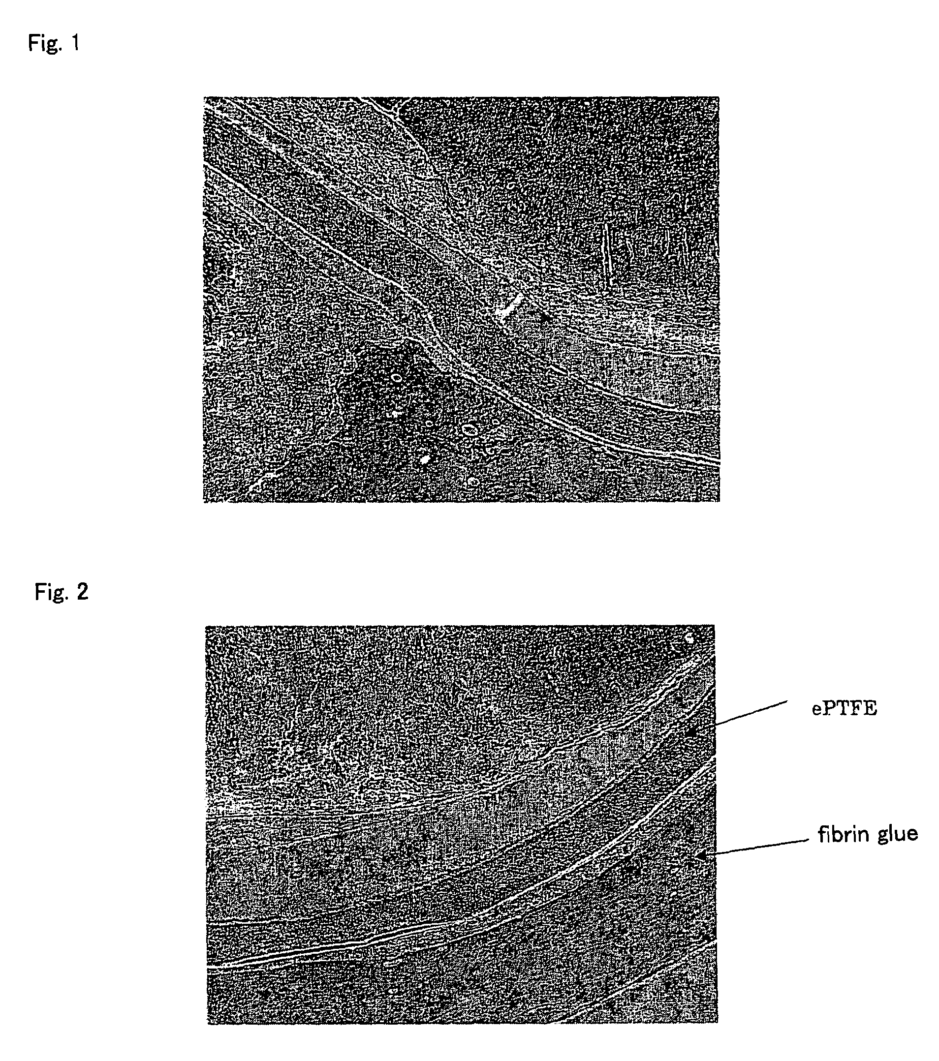 Biological repair material compatible with biological tissue adhesive