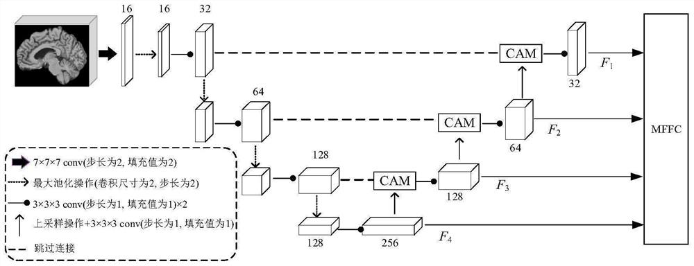 SMRI image classification method based on high-resolution complementary attention UNet classifier