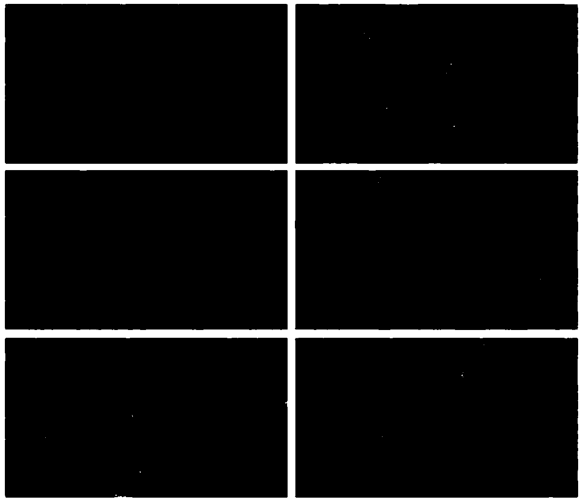 Stem cell preparation sponge patch complex for treating cerebral diseases as well as preparation method and application thereof