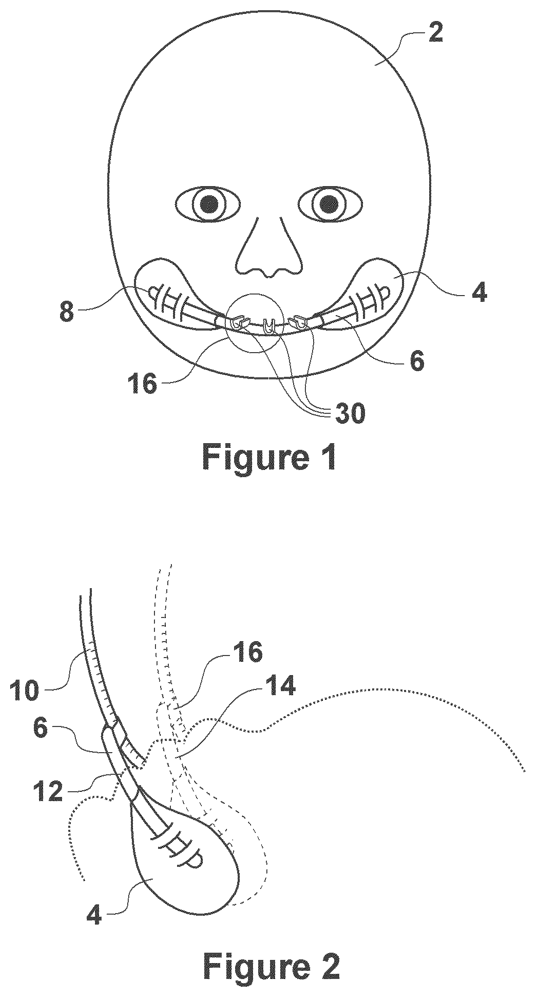 Patient tube securement apparatus for securing a patient tube to a patient