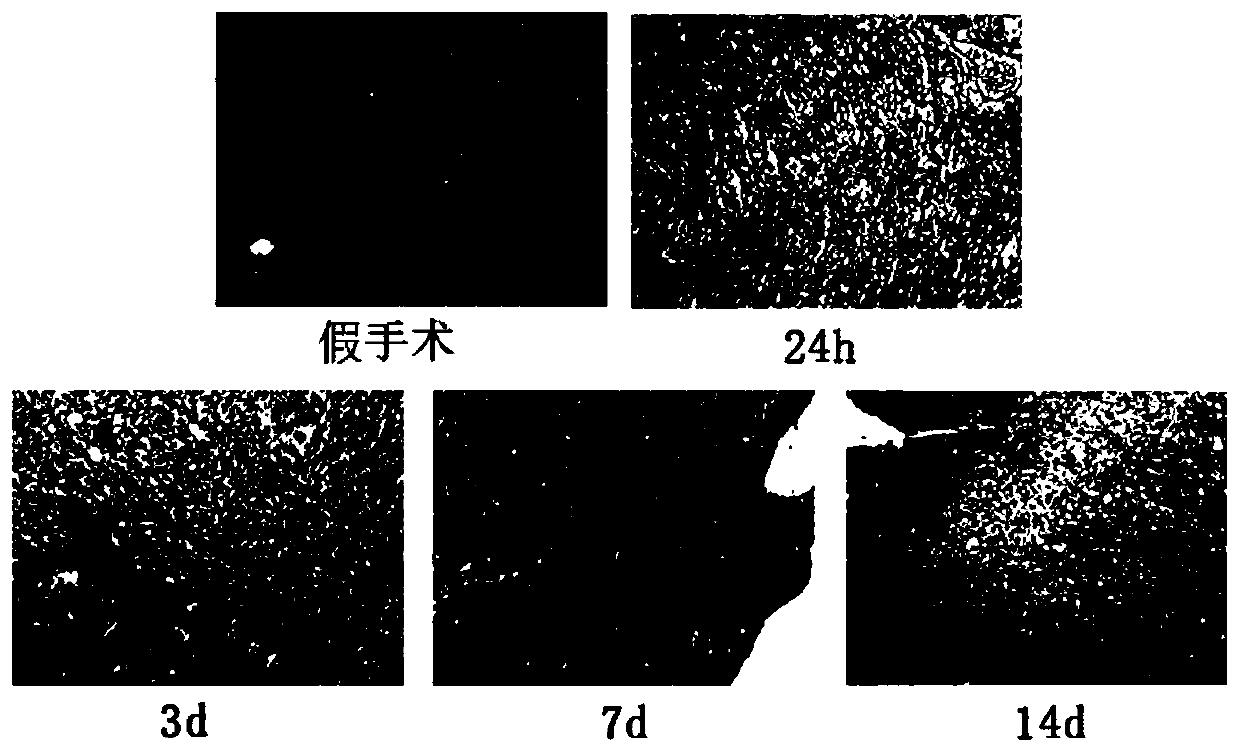 Application of Guanxin Danshen Compound Preparation in the Preparation of Drugs for Improving Ventricular Remodeling