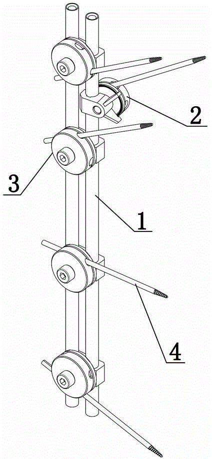 Tubular connecting rod device and outer-bone fixing device