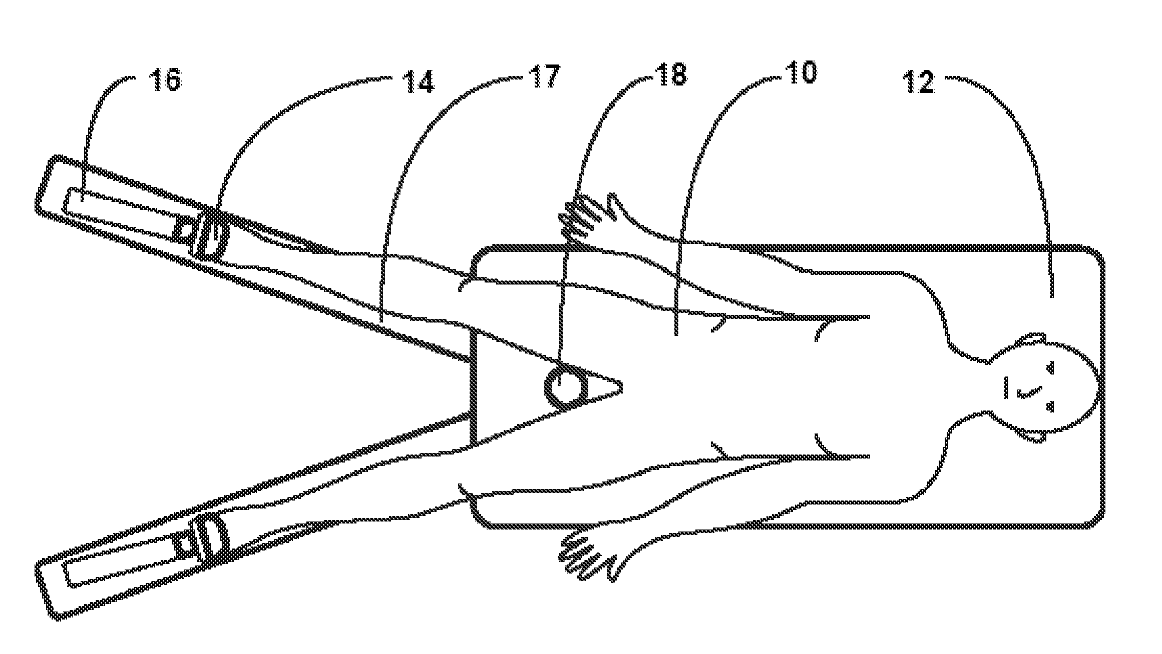 Method and Apparatus for Monitoring Surgical Traction