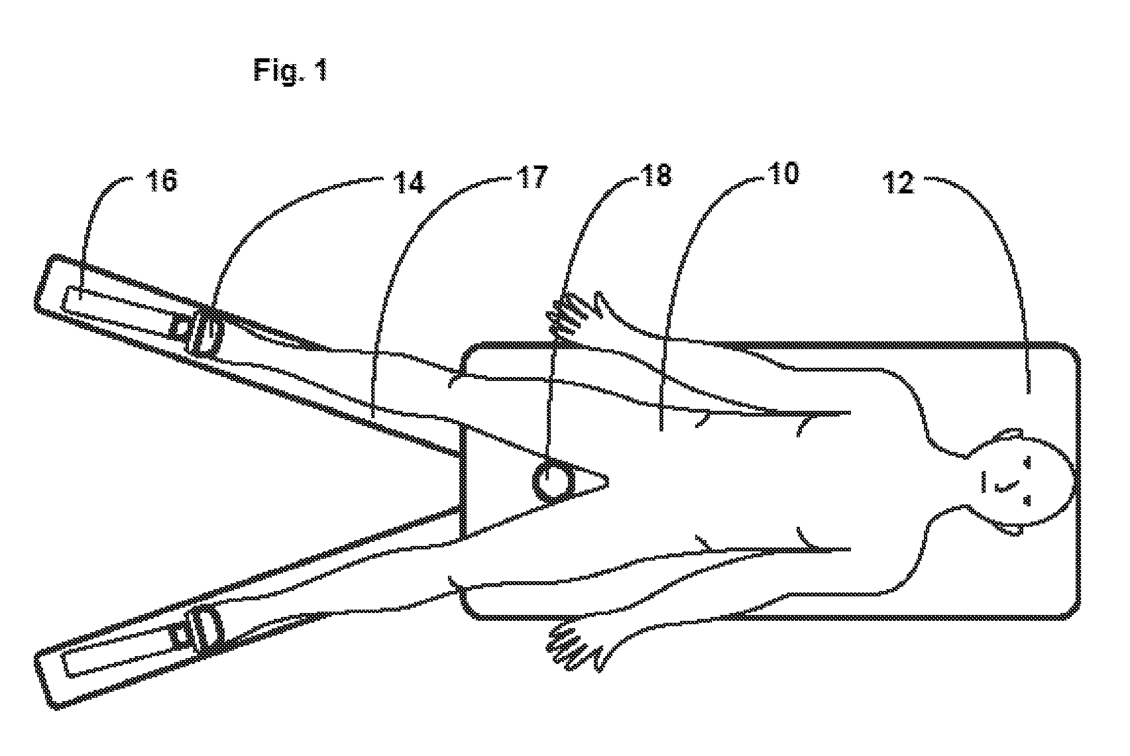 Method and Apparatus for Monitoring Surgical Traction