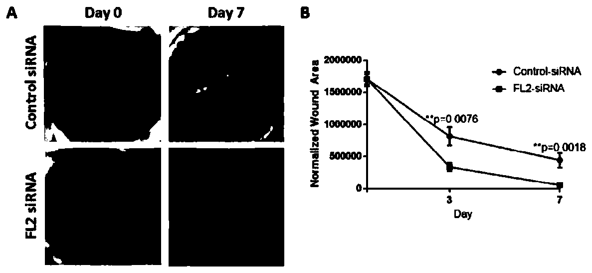 Application of FL2-siRNA in preparation of drug for treating corneal alkali burn and corneal alkali burn drug