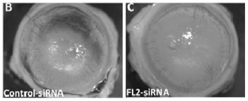 Application of FL2-siRNA in preparation of drug for treating corneal alkali burn and corneal alkali burn drug