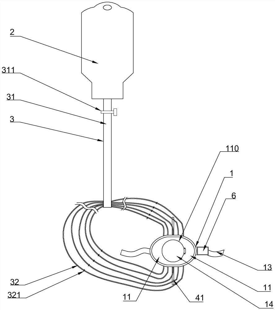 A conjunctival sac irrigation and collection system