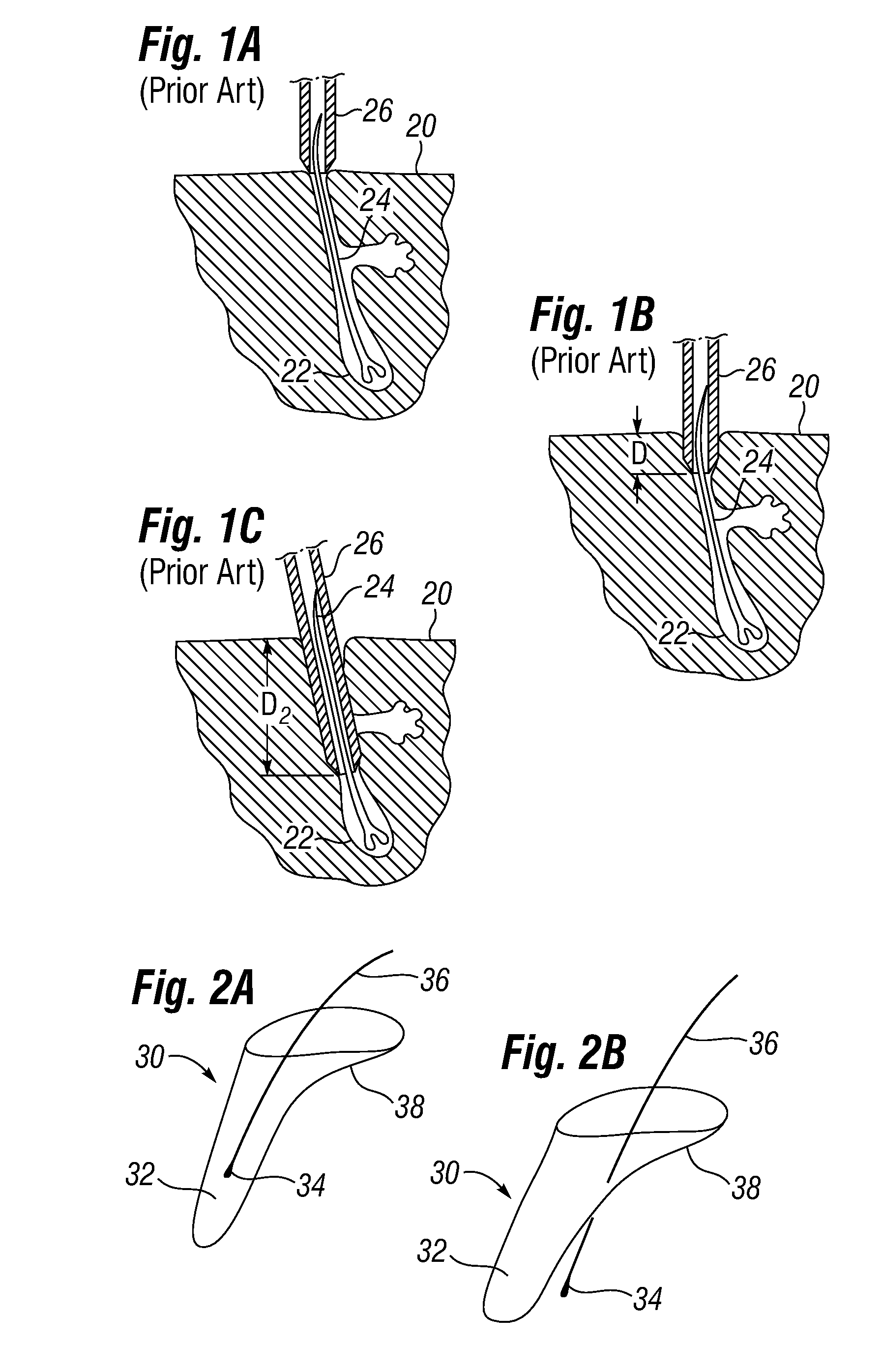 Biological unit removal tools with retention mechanism