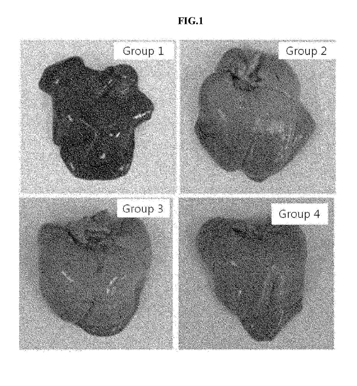 Composition for preventing or treating hyperlipidemia