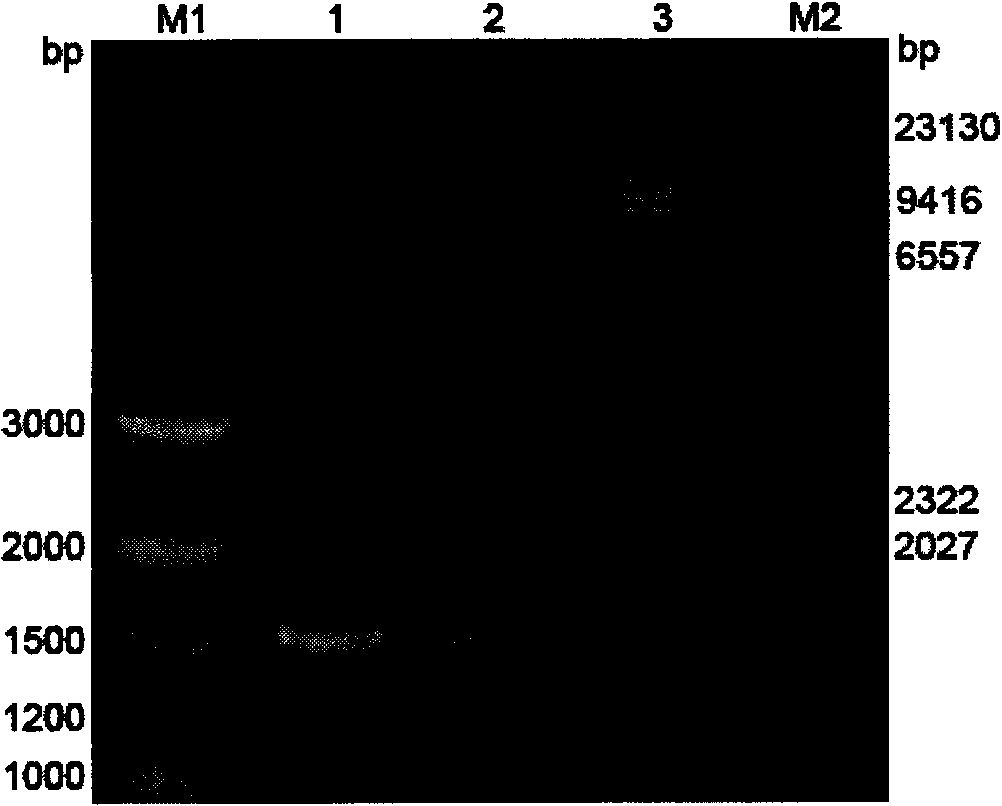 Human aldehyde dehydrogenase 2 sequence designed according to preferred codon of pichia pastoris