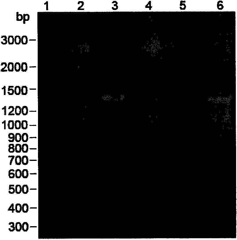 Human aldehyde dehydrogenase 2 sequence designed according to preferred codon of pichia pastoris