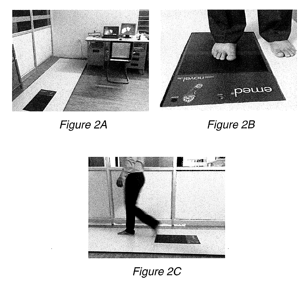 Process of manufacture of customized split insole for diabetic patients