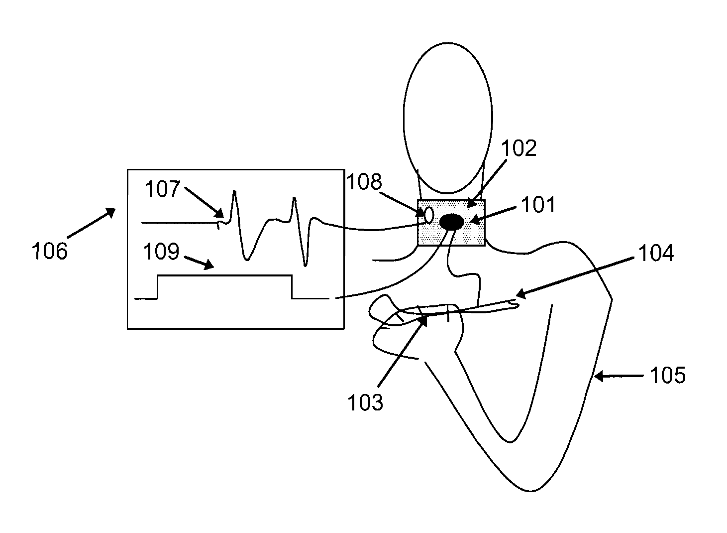 Device for volitional swallowing with a substitute sensory system