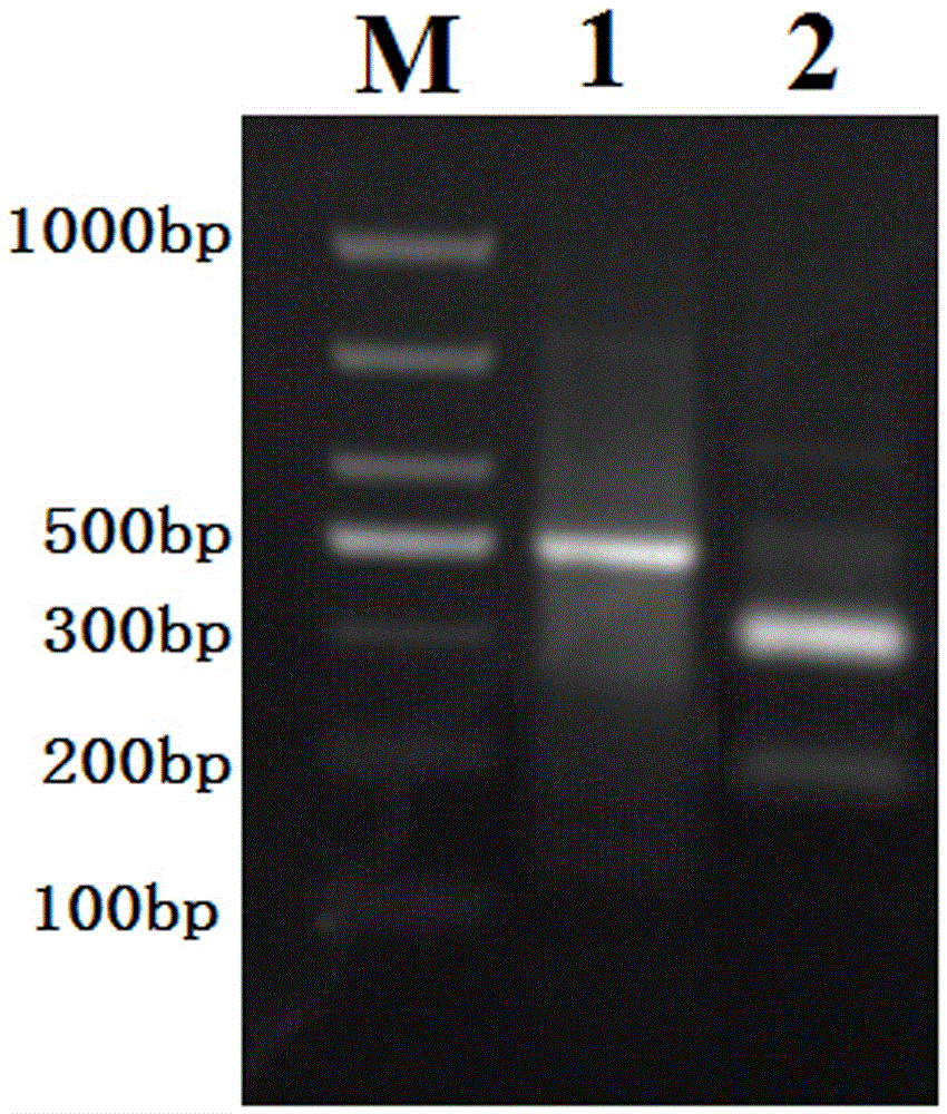 Runx1 gene fragmentation and copy number increase detection kit and preparation method thereof