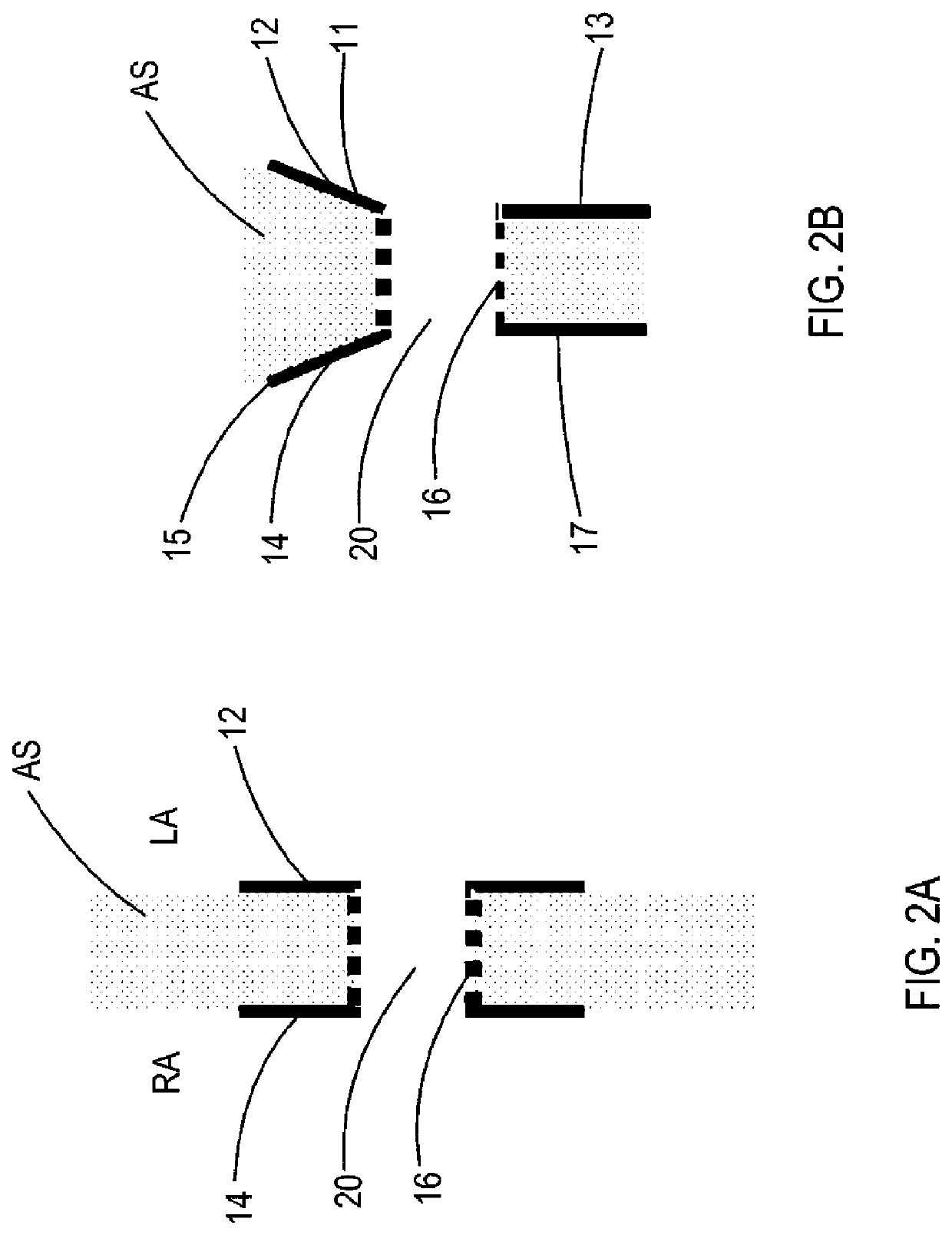 Devices and methods for providing passage between heart chambers