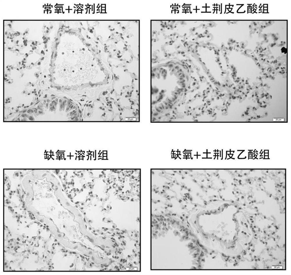 Application of golden larch bark acetic acid in preparation of medicine for treating pulmonary arterial hypertension