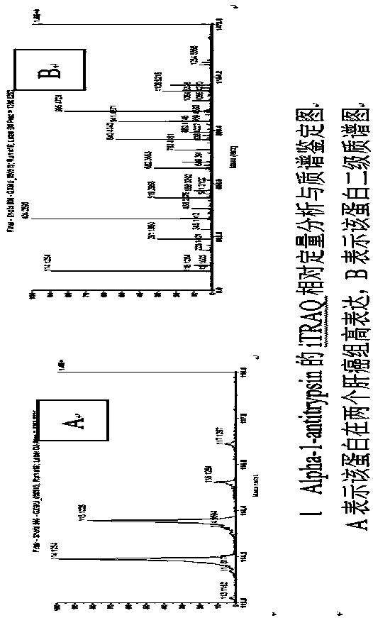 Method used for discovering and identifying liver cancer serum differential expression proteins and verifying marker proteins