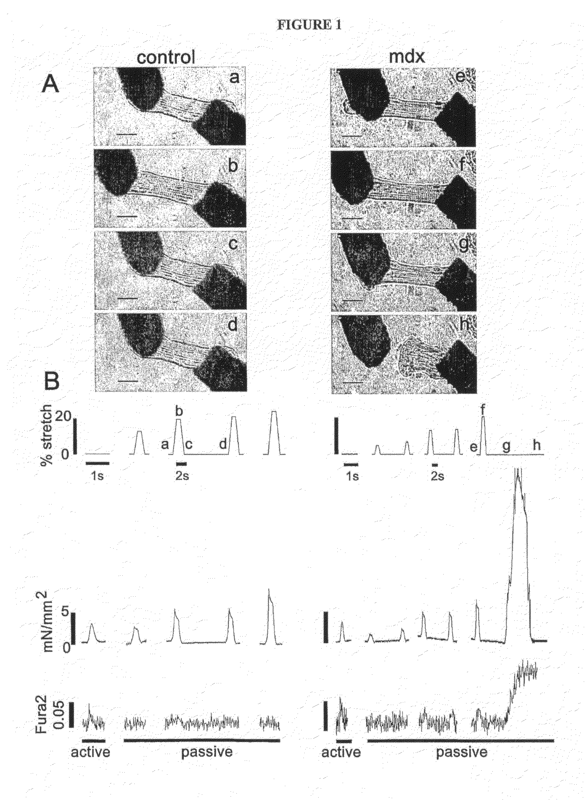 Compositions and methods for treating and preventing cardiomyopathy and heart disease