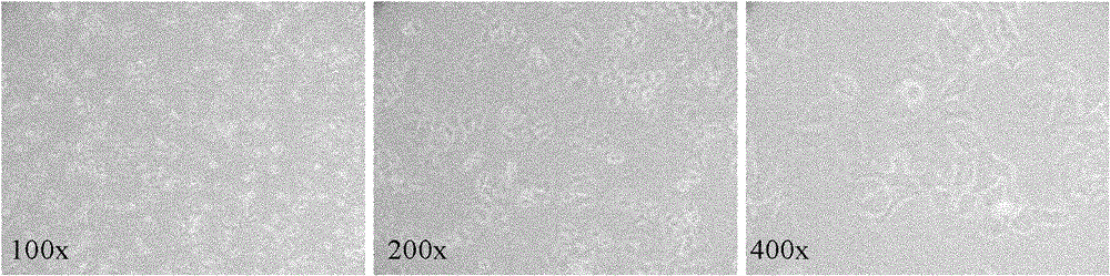 Establishment and application of hepatocellular carcinoma cell line HCC-LY5