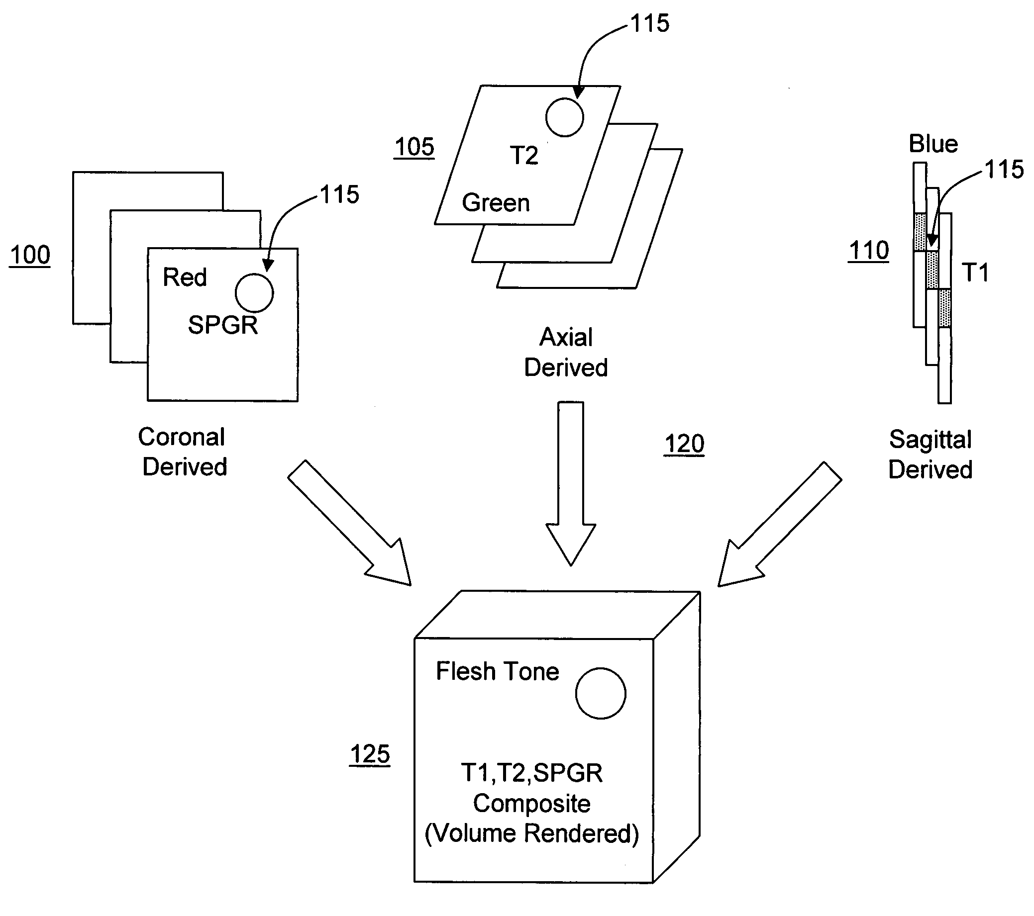 Opposed orthogonal fusion system and method for generating color segmented MRI voxel matrices