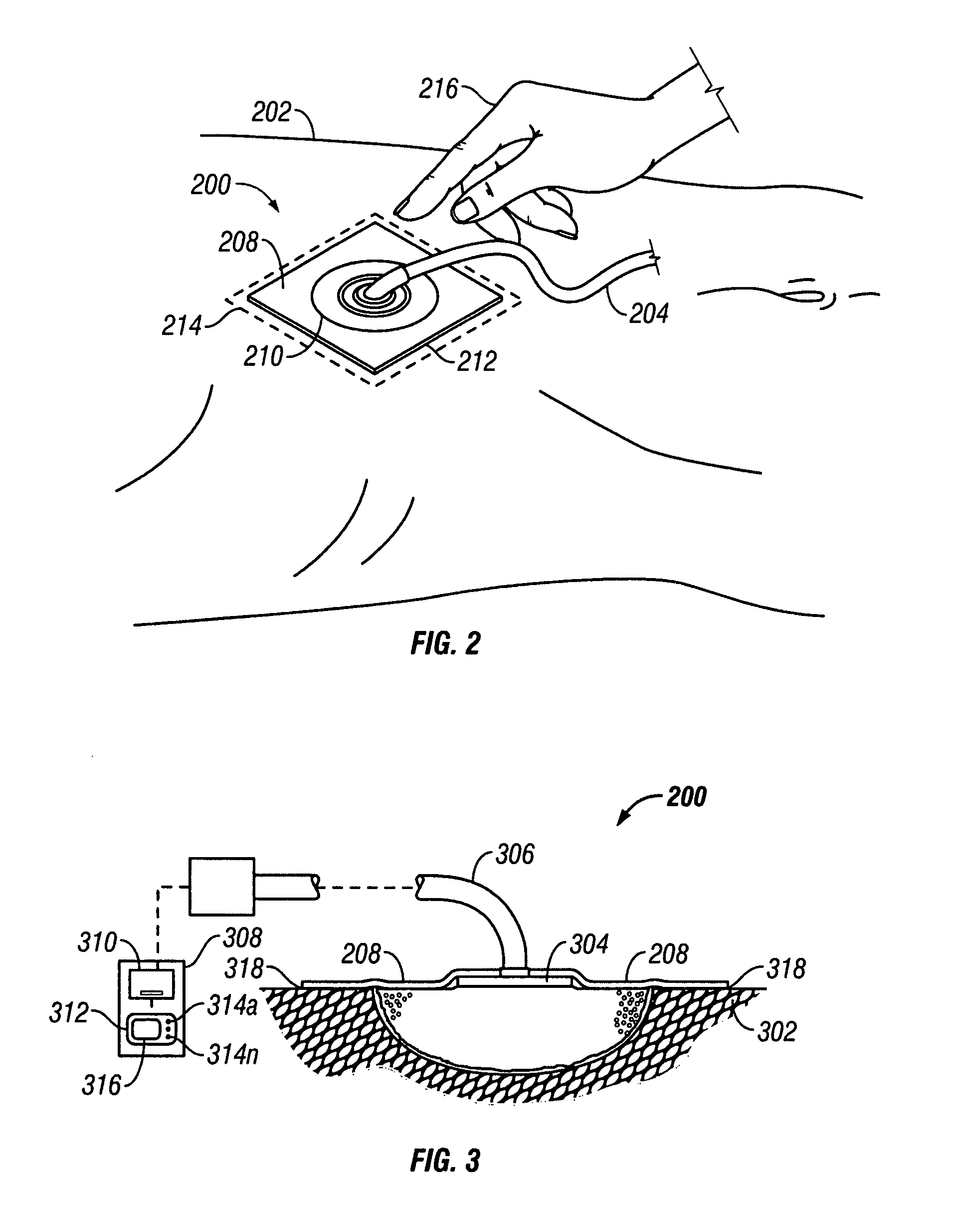 System and method for locating fluid leaks at a drape of a reduced pressure delivery system