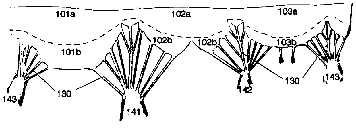 Tricuspid valvuloplasty ring